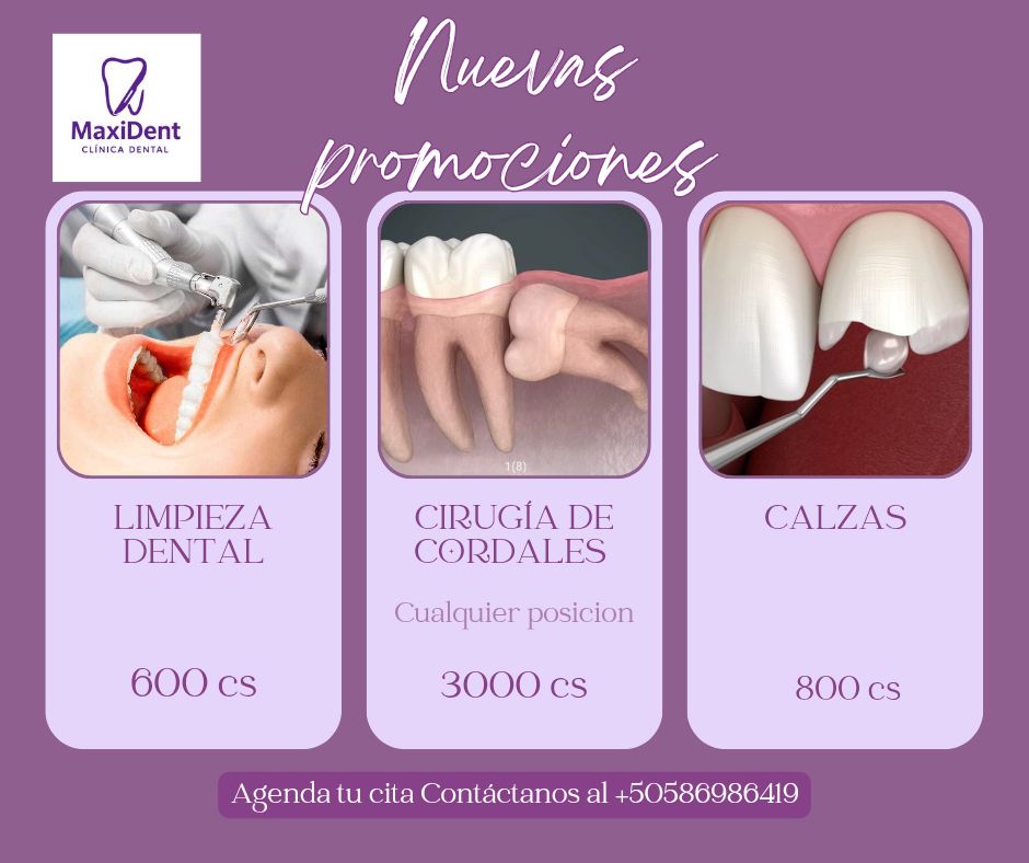 Nuevas Promociones MaxiDent - Limpieza Dental, Cirugía de Cordales, Calzas