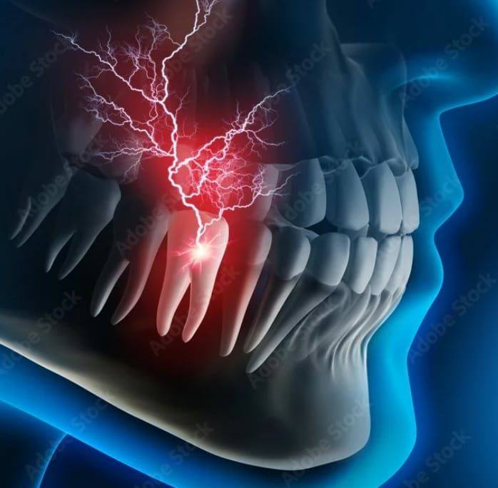 Tecnología de Radiografía Digital en MaxiDent
